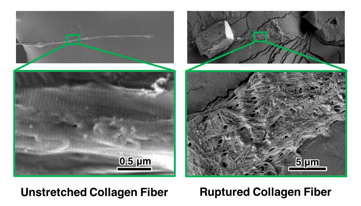 Scanning electron microscopy images of collagen fibers.