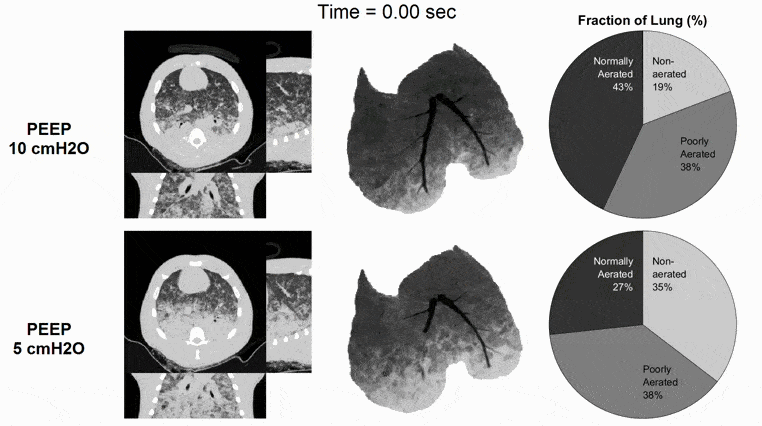 Quantitative dynamic CT imaging example