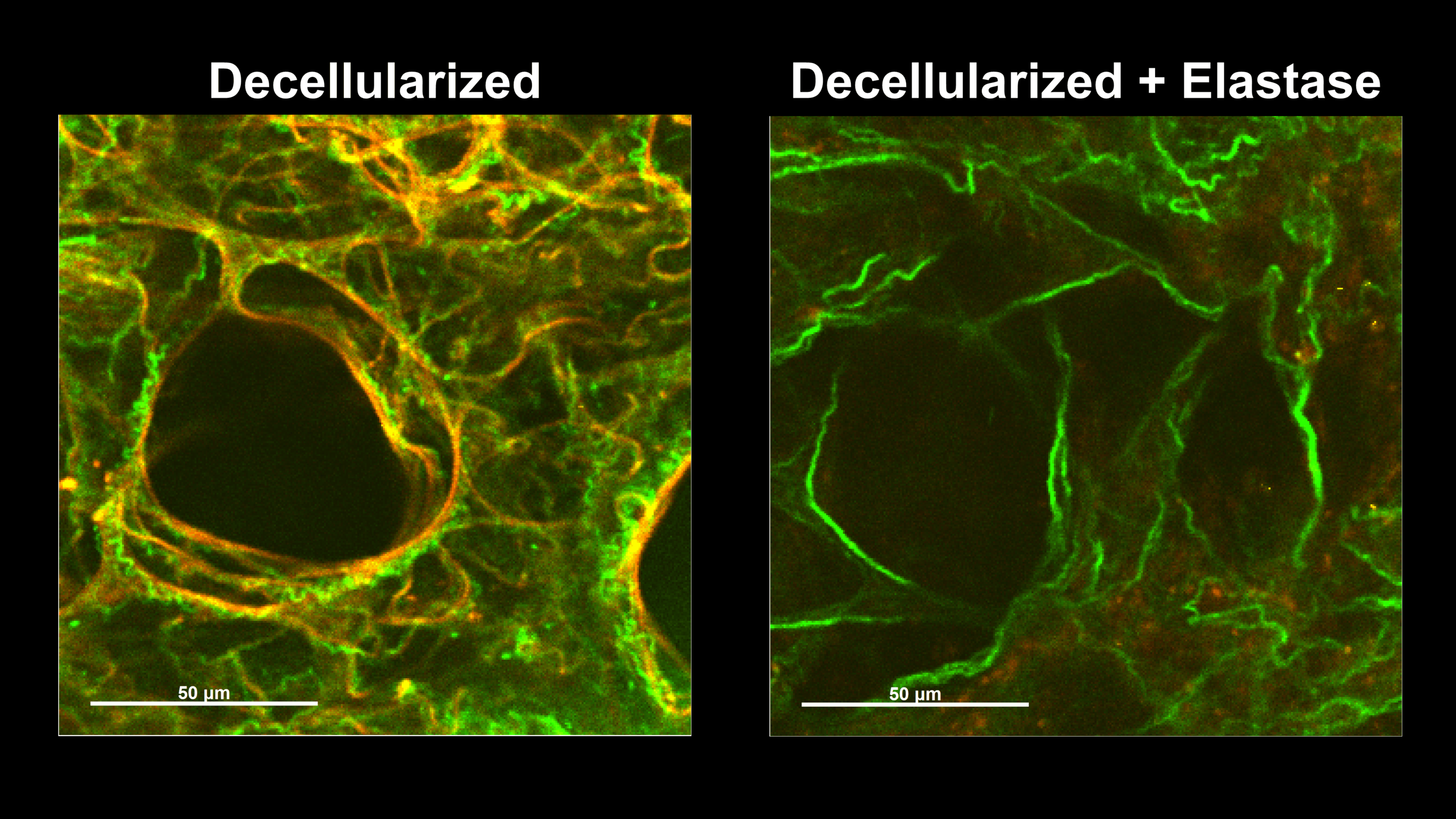 Collagen after elastin degradation