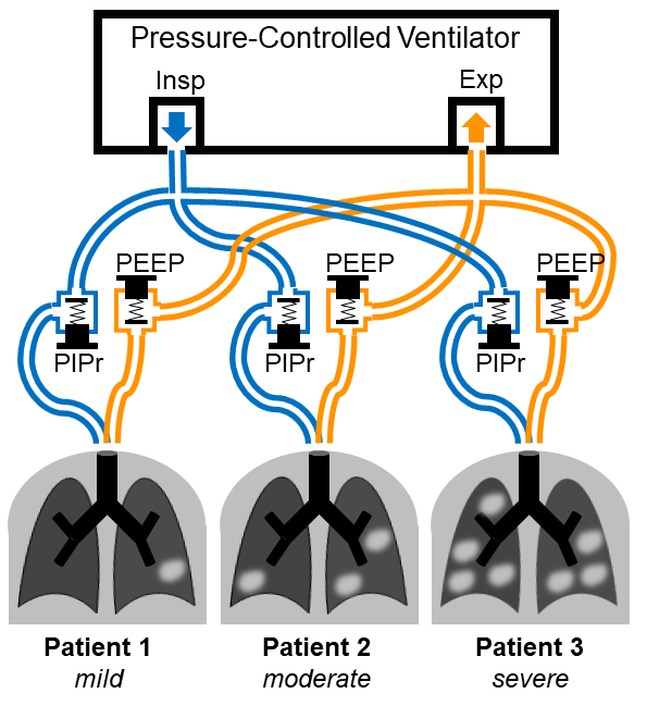 Ventilator sharing with independent pressure control