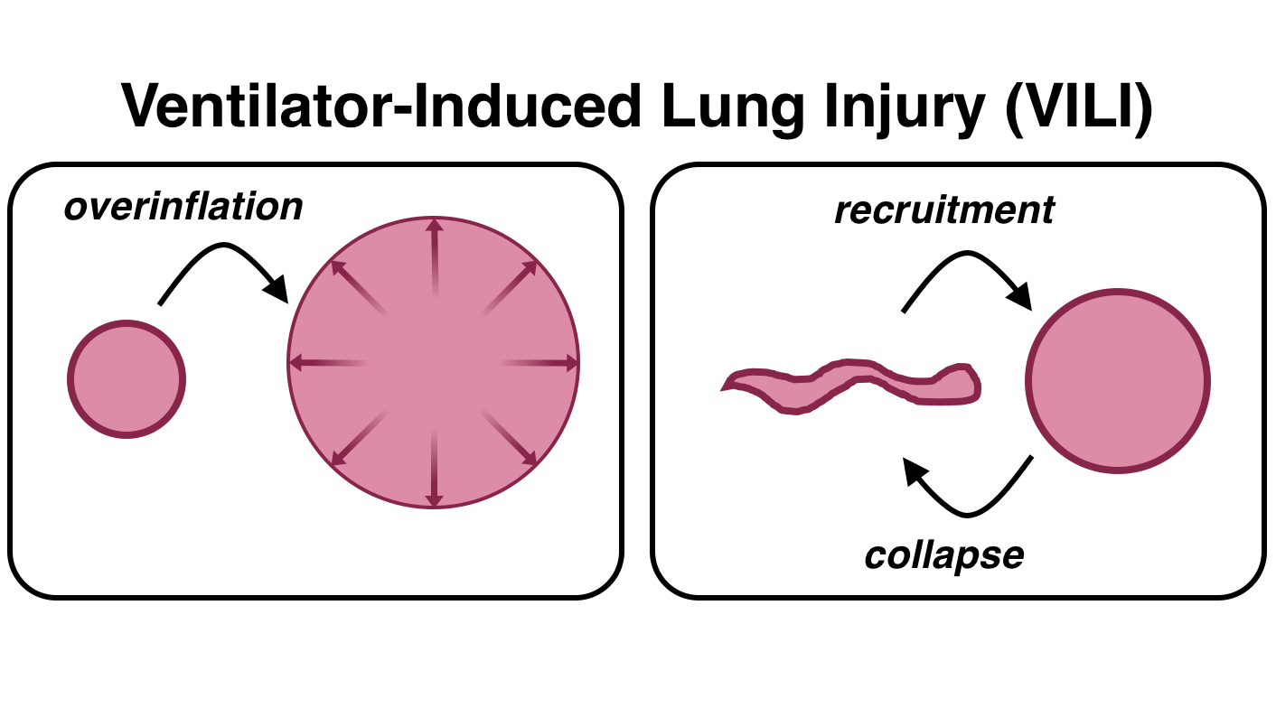 Ventilator-Induced Lung Injury schematic